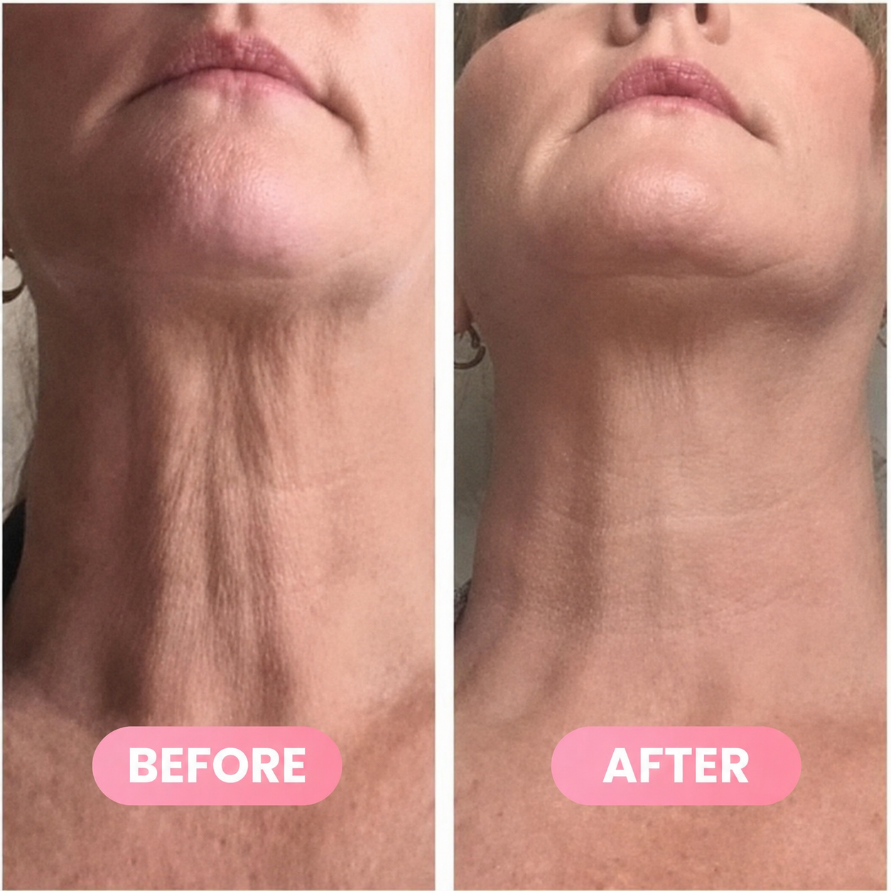 Collagen Gua Sha Neck Wrinkle Cream🥰