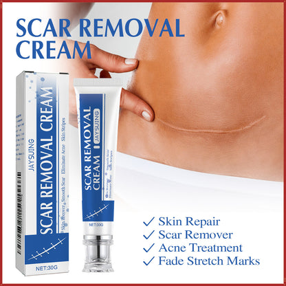 SCAR REMOVAL CREAM - Helps reduce scars and acne marks