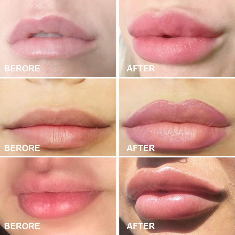 Silicone Fish Shape Lips Enhancer